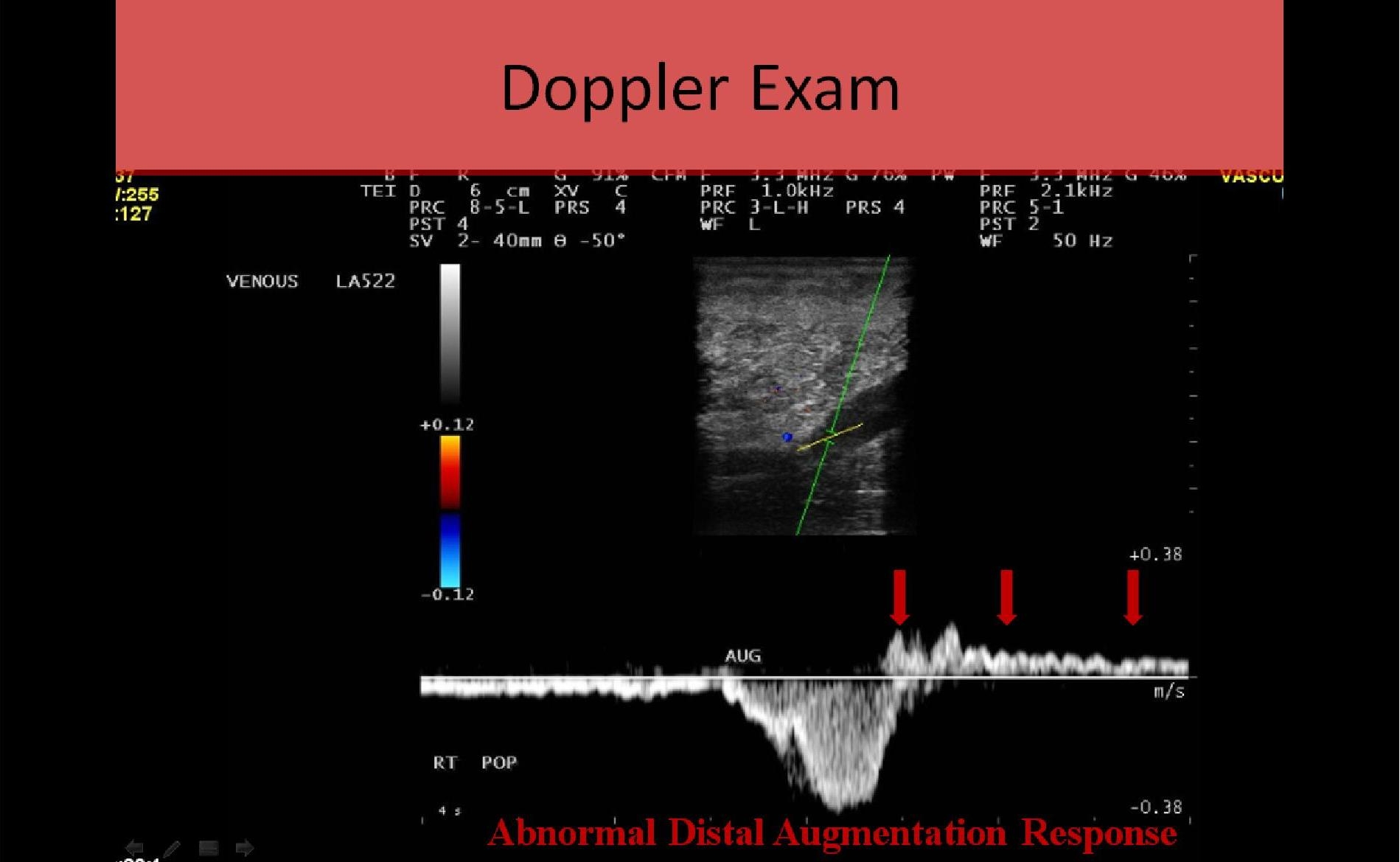 Vascular Ultrasound Registry Review Course